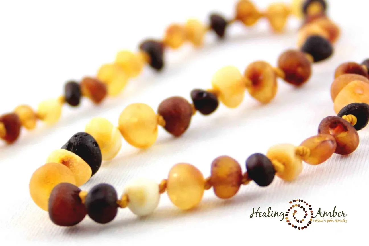 Healing Amber Necklace - 11 Inches